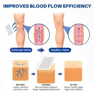 𝐆𝐋𝐎𝑹𝑬𝗡𝗗𝗔® 𝗩𝗲𝒊𝒏 𝐂𝒐𝒏𝘁𝗼𝐮𝐫 𝐌𝐢𝐜𝐫𝐨𝒏𝒆𝒆𝒅𝗹𝗲 𝑷𝒂𝒕𝐜𝐡 (𝐉𝐮𝐬𝐭 𝐎𝐧𝐜𝐞 𝐀 𝐃𝐚𝐲, 𝐒𝐞𝐞 𝐑𝐞𝐬𝐮𝐥𝐭𝐬 𝐈𝐧 𝟕 𝐃𝐚𝐲𝐬) — 👩‍⚕️🏆 𝐒𝐮𝐢𝐭𝐚𝐛𝐥𝐞 𝐅𝐨𝐫 𝐕𝐚𝐫𝐢𝐜𝐨𝐬𝐞 𝐕𝐞𝐢𝐧𝐬 𝐀𝐧𝐝 𝐒𝐩𝐢𝐝𝐞𝐫 𝐕𝐞𝐢𝐧𝐬, 𝐑𝐞𝐥𝐢𝐞𝐯𝐞𝐬 𝐇𝐞𝐚𝐯𝐲, 𝐓𝐢𝐫𝐞𝐝 𝐋𝐞𝐠